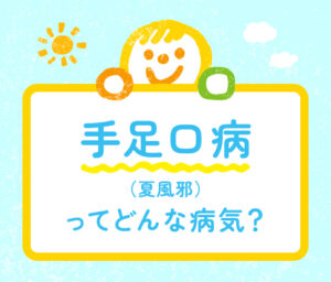 手足口病（夏風邪）の症状・特徴・登園の目安をわかりやすく紹介